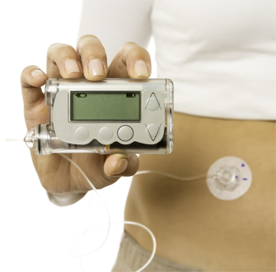 Insulin Infusion Pumps